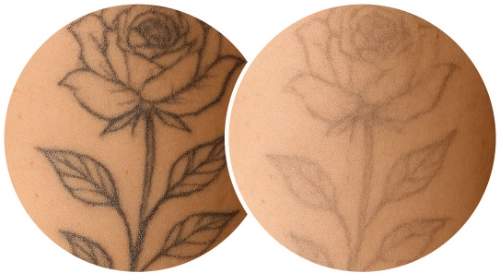 faded-pair laser tattoo fading